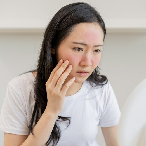 calms irritated skin