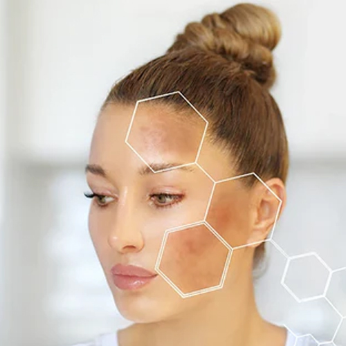 reduces dark patches (1)