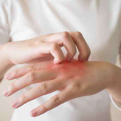 soothes rashes probiotic face wash