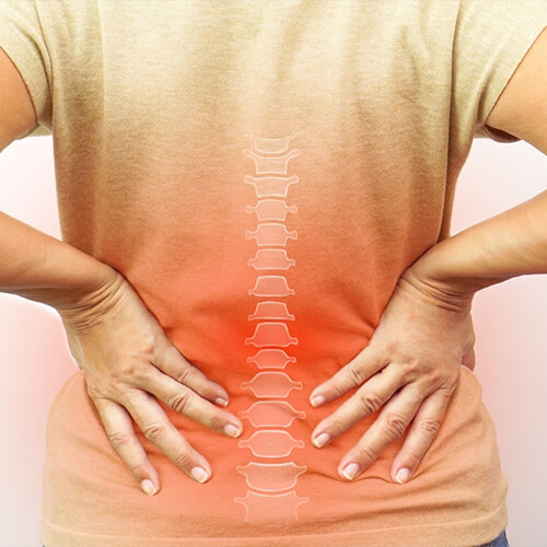 joint stiffness