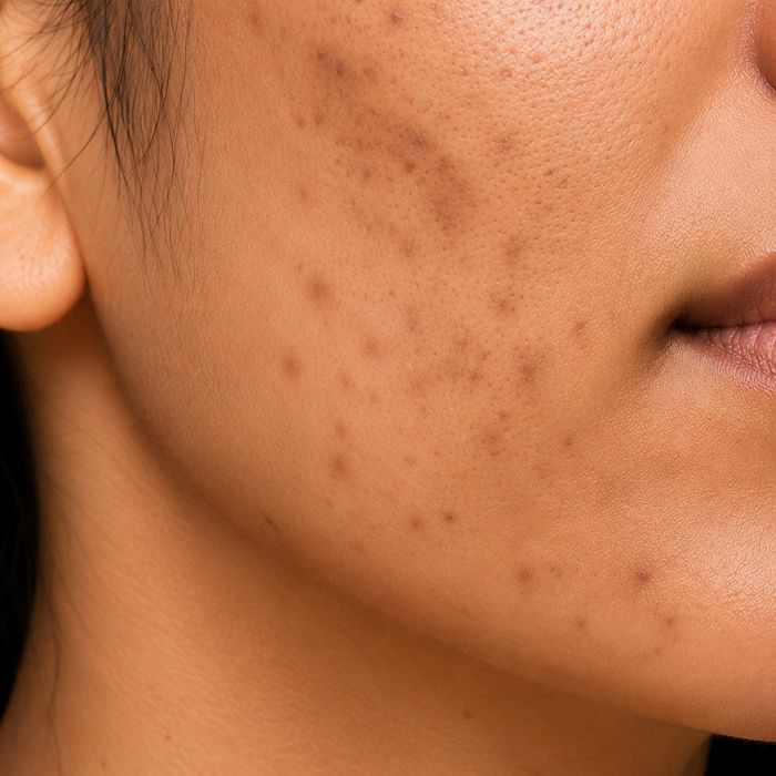 Dark Spots